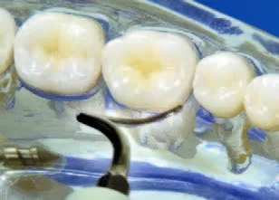 Заказать Насадка для скалера #H4L | Acteon в интернет-магазине dialog.dental