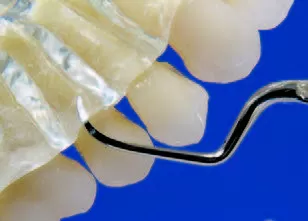 Заказать Насадка для скалера #H4R | Acteon в интернет-магазине dialog.dental