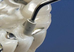 Приобрести Насадка для скалера #C20 | Acteon в интернет-магазине dialog.dental