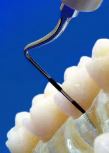 Заказать Насадка для скалера #TK1-1L | Acteon в интернет-магазине dialog.dental