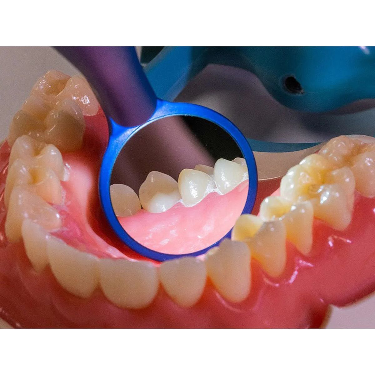 В наличии М1. Зеркало стоматологическое ультраяркое, со встроенным светом. Коэф. отражения 98%. | Dialog в интернет-магазине dialog.dental