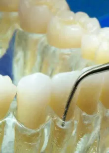 Заказать Насадка для скалера #H1 | Acteon в интернет-магазине dialog.dental