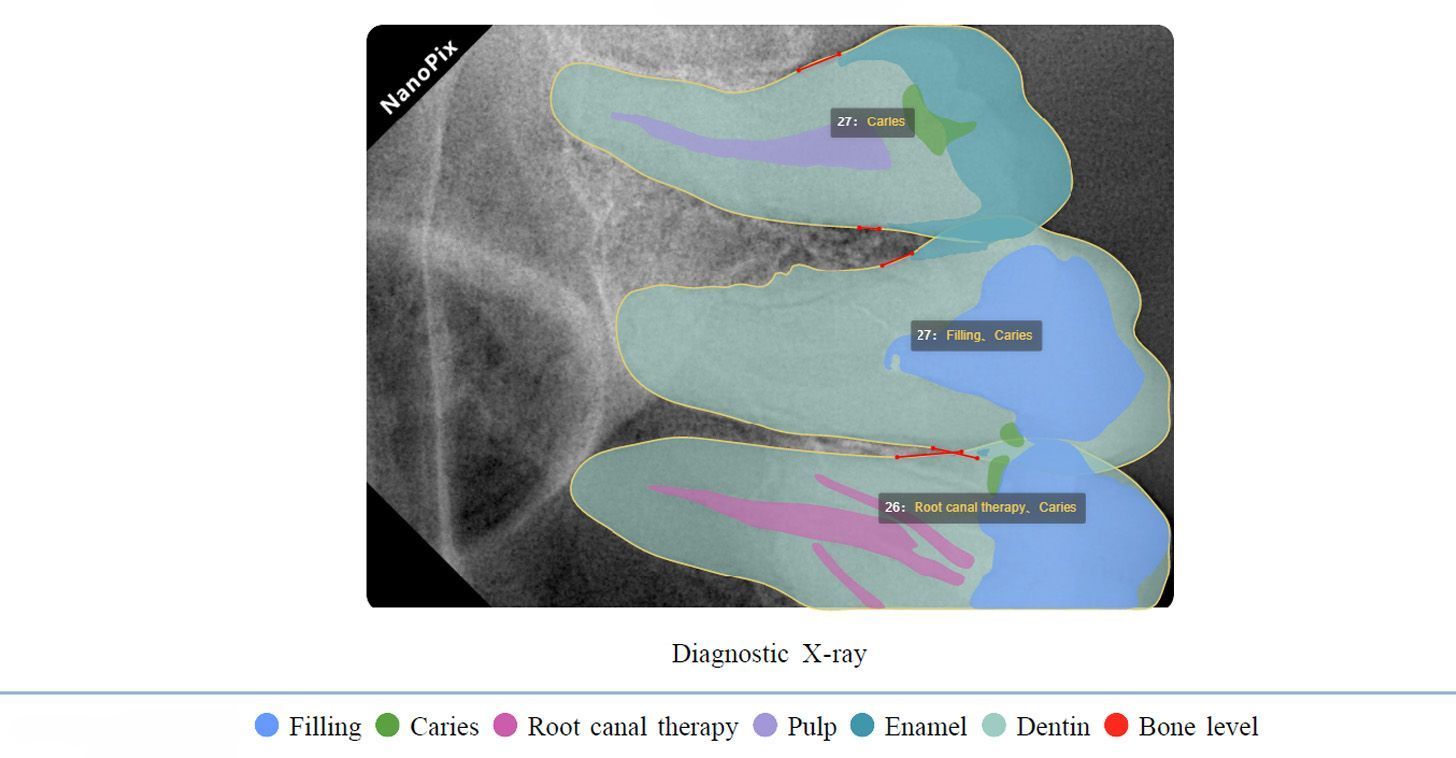 В наличии Комплект рентген + визиограф | Eighteeth в интернет-магазине dialog.dental