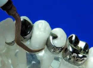 Заказать Насадка для скалера #PH1 | Acteon в интернет-магазине dialog.dental