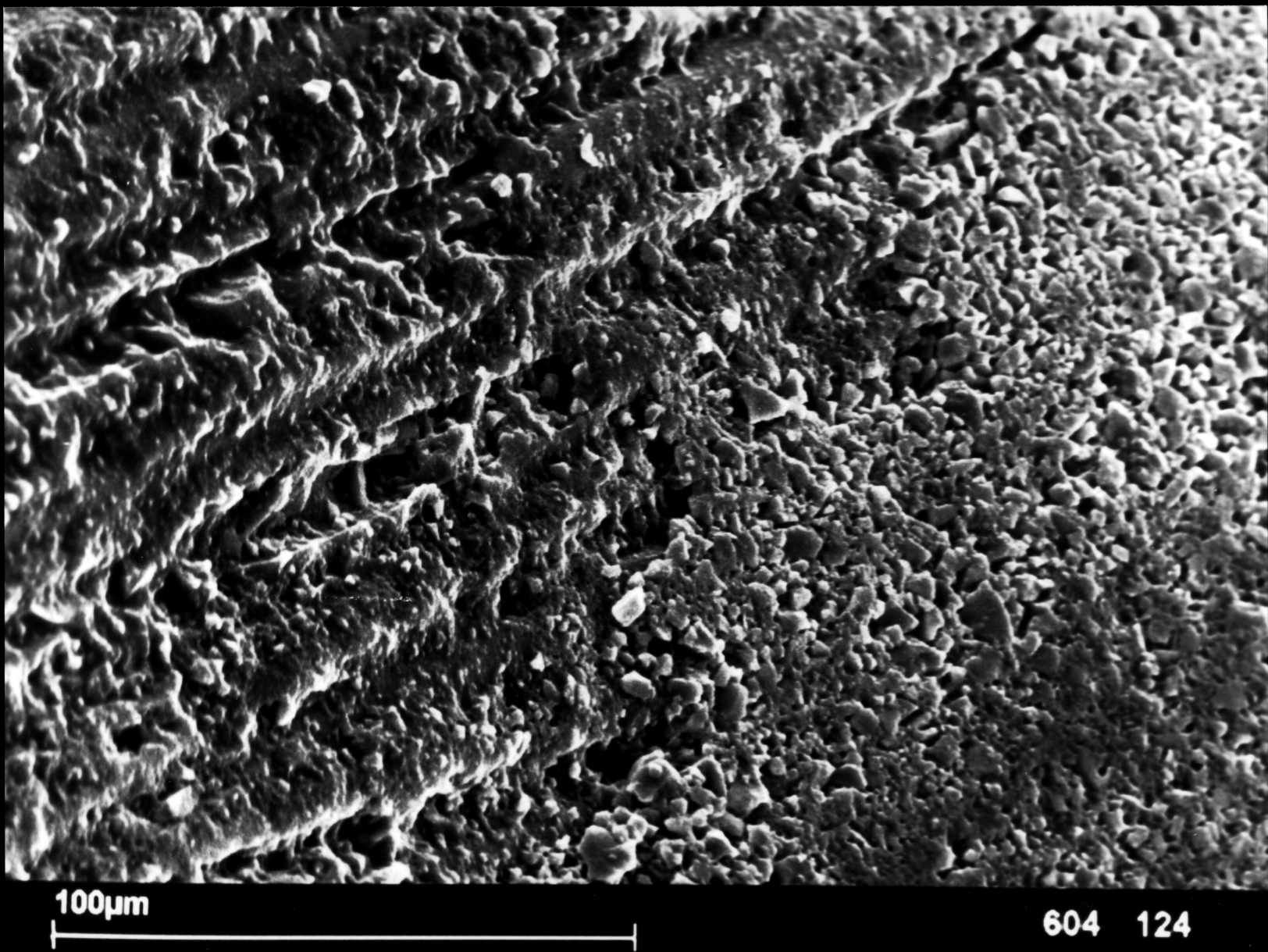 Набор CYTECpro eco: стекловолоконные штифты (30 шт) + корневые развертки (8 шт) | HAHNENKRATT в интернет-магазине dialog.dental