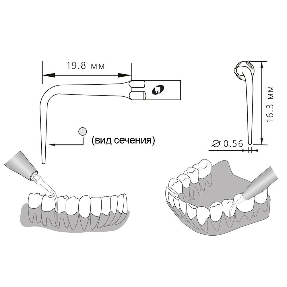 Приобрести Насадка для скалера P53L/P53L-S | Eighteeth в интернет-магазине dialog.dental