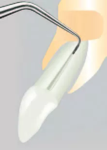 Заказать Насадка для скалера #AS3D | Acteon в интернет-магазине dialog.dental