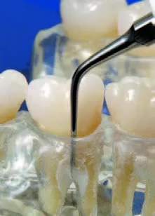 Заказать Насадка для скалера #H2L | Acteon в интернет-магазине dialog.dental