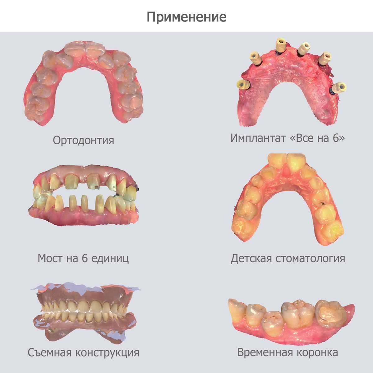  Беспроводной интраоральный сканер Shining 3D Aoralscan 3 Wireless | SHINING 3D в интернет-магазине dialog.dental