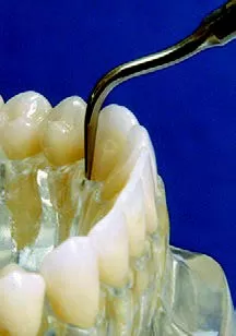 Заказать Насадка для скалера #10P | Acteon в интернет-магазине dialog.dental