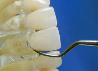 Заказать Насадка для скалера #H3 | Acteon в интернет-магазине dialog.dental